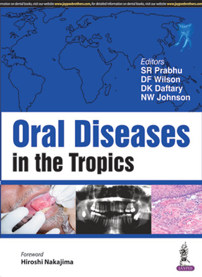 ORAL DISEASES IN THE TROPICS, 1/E, BY, SR PRABHU