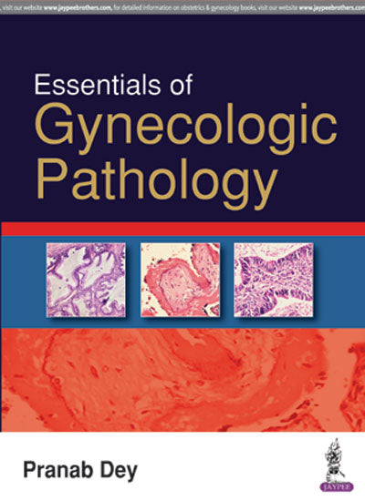 ESSENTIALS OF GYNECOLOGIC PATHOLOGY 1/E, 2017, PRANAB DEY
