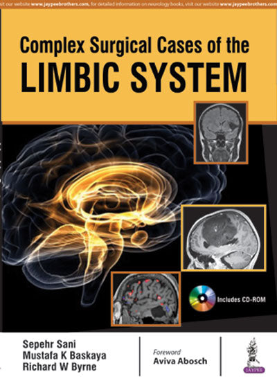 COMPLEX SURGICAL CASES OF THE LIMBIC SYSTEM 1/E, 2017, SEPEHR SANI