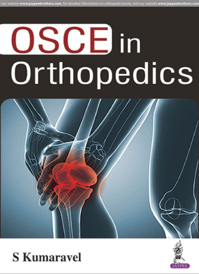 OSCE IN ORTHOPEDICS 1/E, 2017, S KUMARAVEL