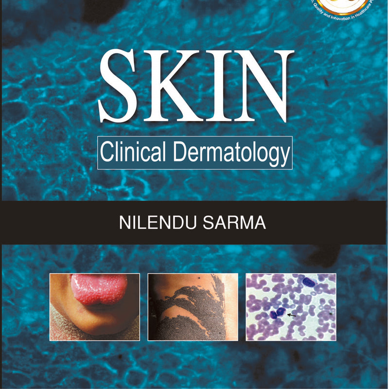 SKIN CLINICAL DERMATOLOGY, 1/E, BY, NILENDU SARMA