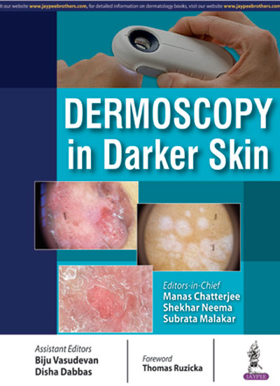DERMOSCOPY IN DARKER SKIN, 1/E, BY, MANAS CHATTERJEE