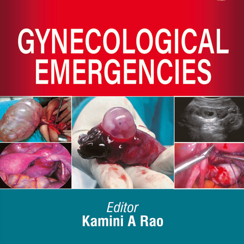 GYNECOLOGICAL EMERGENCIES, 2/E, BY, KAMINI A RAO