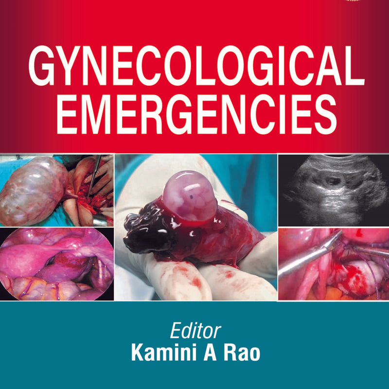 GYNECOLOGICAL EMERGENCIES 2/E, 2020, KAMINI A RAO