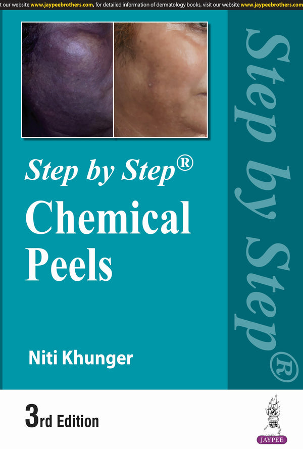 STEP BY STEP CHEMICAL PEELS 3/E, 2024, NITI KHUNGER