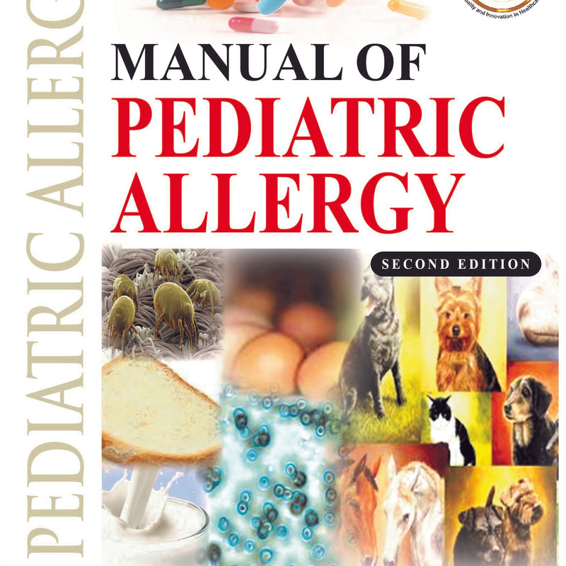 MANUAL OF PEDIATRIC ALLERGY 2/E, 2021, MAJOR K NAGARAJU