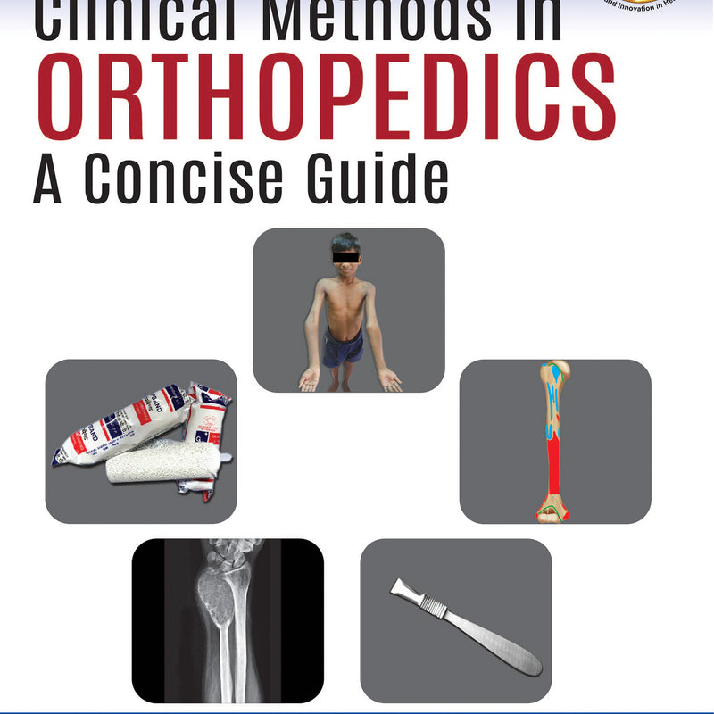 CLINICAL METHODS IN ORTHOPEDICS: A CONCISE GUIDE, 1/E R.P., BY, UPENDRA KUMAR