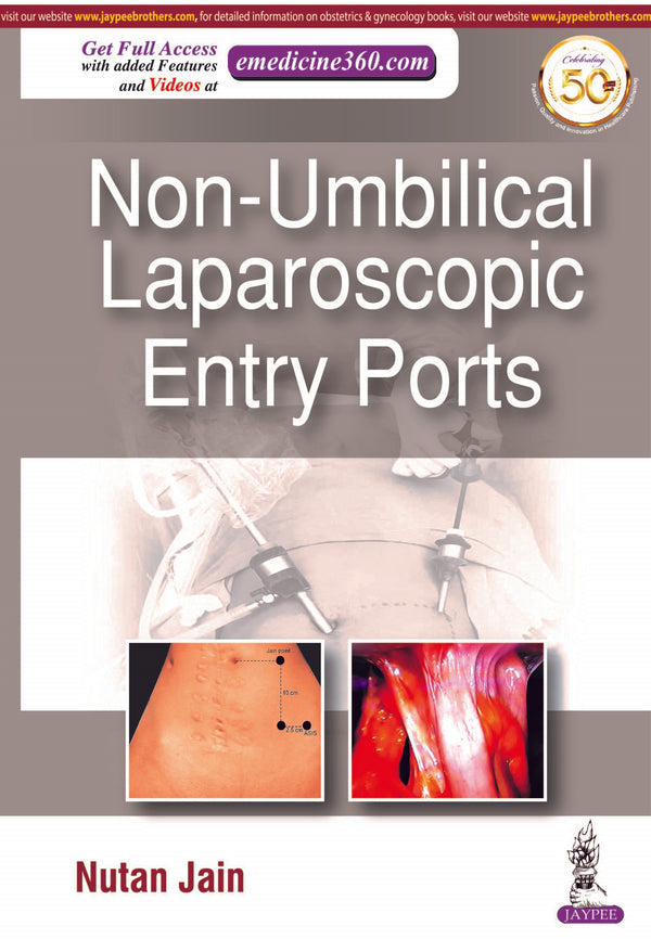 NON-UMBILICAL LAPAROSCOPIC ENTRY PORTS 1/E, 2020, NUTAN JAIN