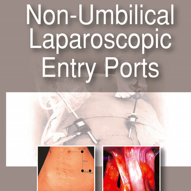 NON-UMBILICAL LAPAROSCOPIC ENTRY PORTS, 1/E, BY, NUTAN JAIN