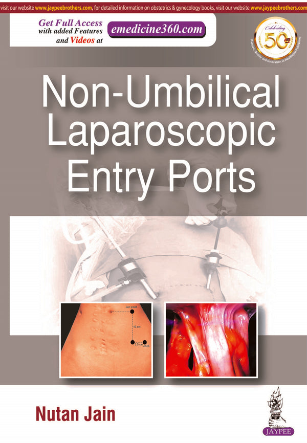 NON-UMBILICAL LAPAROSCOPIC ENTRY PORTS, 1/E, BY, NUTAN JAIN