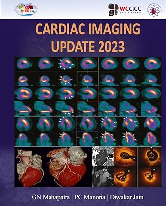 Cardiac Imaging Update 2023 by G N Mahapatra