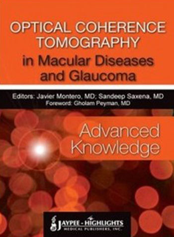 OPTICAL COHERENCE TOMOGRAPHY IN MACULAR DISEASES AND GLAUCOMA(ADVANCED KNOWLEDGE), 1/E, BY, MONTERO SAXENA