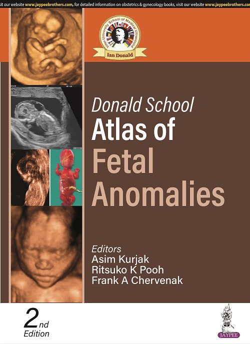DONALD SCHOOL ATLAS OF FETAL ANOMALIES, 2/E,  by ASIM KURJAK