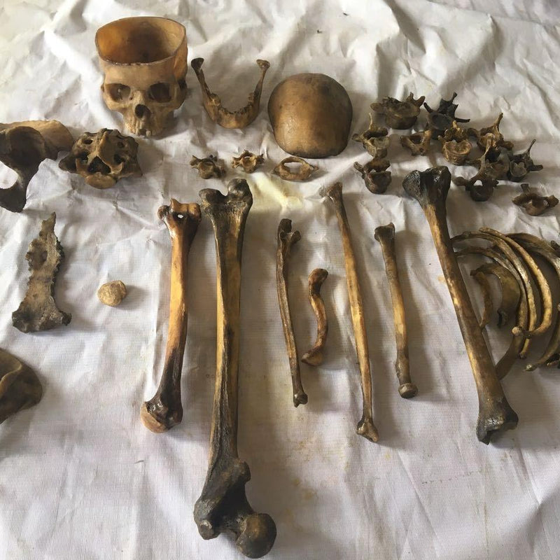 Human Disarticulated Bone Set for MBBS 1st year