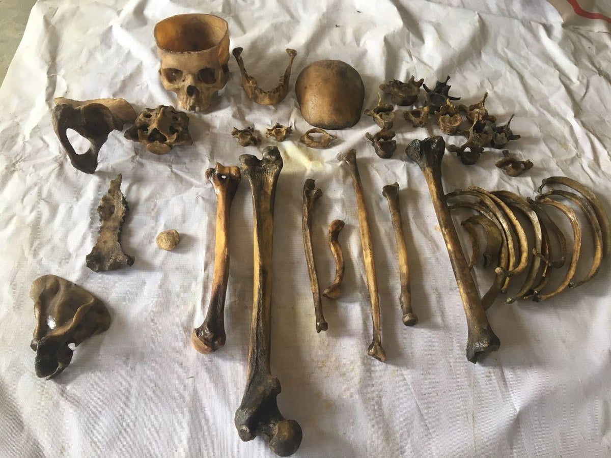 Human Disarticulated Bone Set for MBBS 1st year