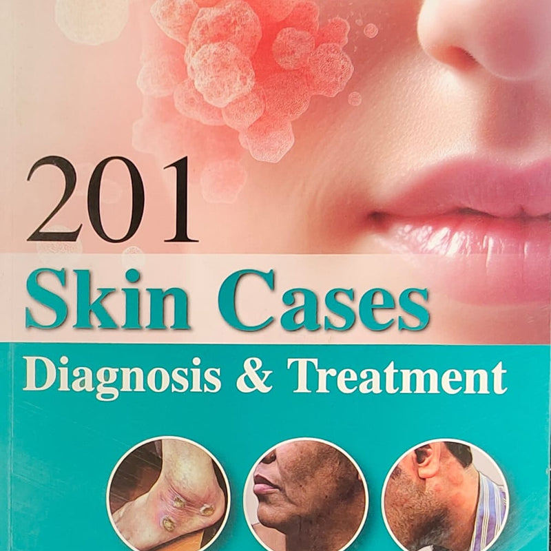 201 SKIN CASES DIAGNOSIS & TREATMENT,4/E,SANJAY GHOSH

151 SKIN CASES DIAGNOSIS & TREATMENT,4/E,SANJAY GHOSH

9789356968653
