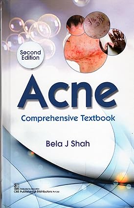 Acne Comprehensive Textbook 2Ed (HB) by Bela J Shah