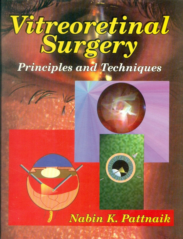 Vitreoretinal Surgery Principles And Techniques (Hb 2003), by Nabin K Pattnaik