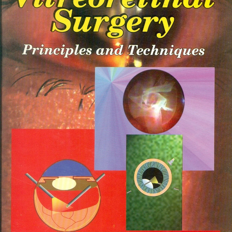 Vitreoretinal Surgery Principles And Techniques (Hb 2003), by Nabin K Pattnaik