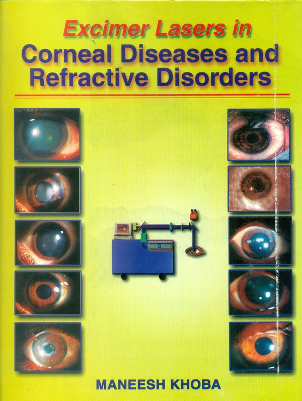 Excimer Lasers In Corneal Diseases And Refractive Disorders (2003), by M Khoba