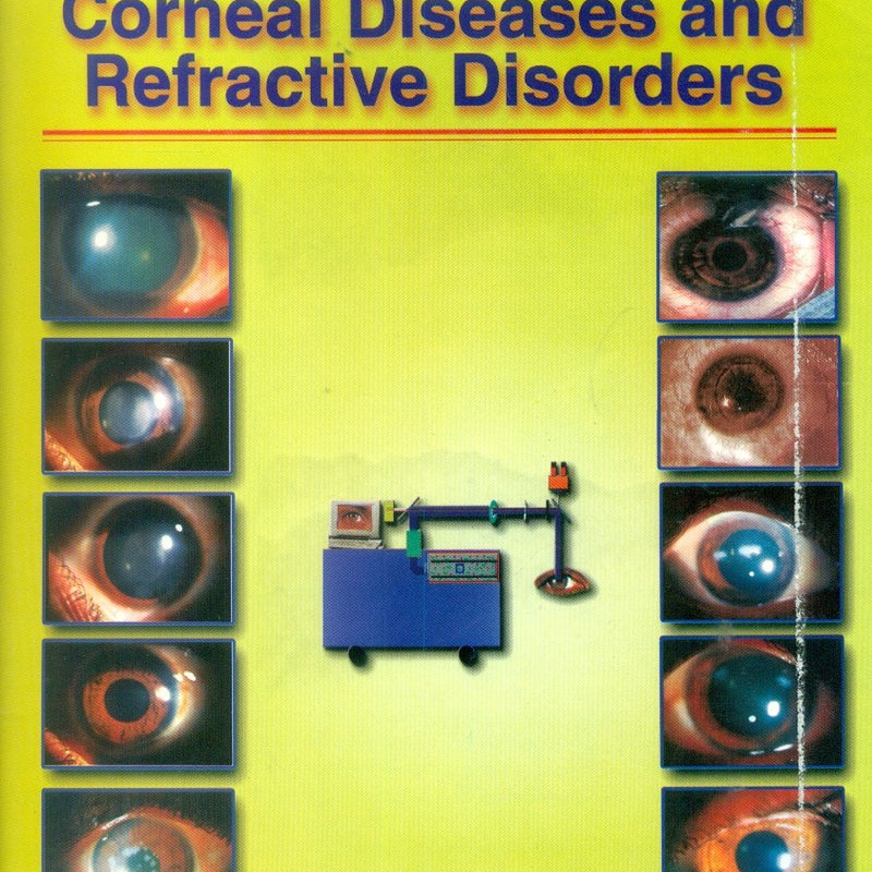 Excimer Lasers In Corneal Diseases And Refractive Disorders (2003), by M Khoba