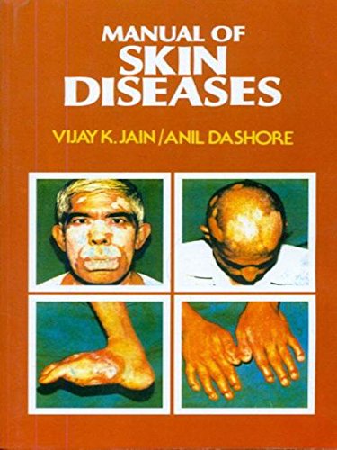 Manual Of Skin Diseases (Pb 2022) , by Vijay K Jain