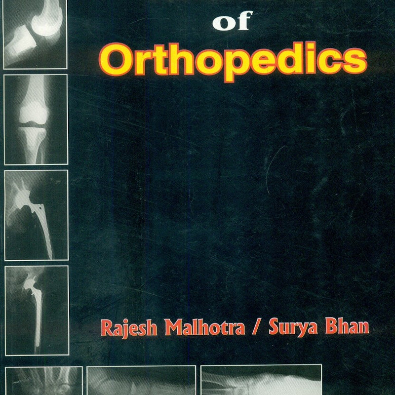 Textbook Of Orthopedics (2004), by Rajesh Malhotra
