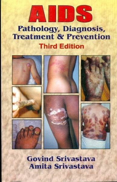 Aids Pathology Diagnosis Treatment And Prevention 3Ed (2012), by Govind Srivastava