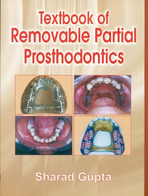 Textbook Of Removable Partial Prosthodontics (2009), by Sharad Gupta
