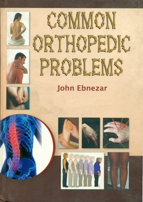 Common Orthopedic Problems (Pb 2016), by John Ebnezar