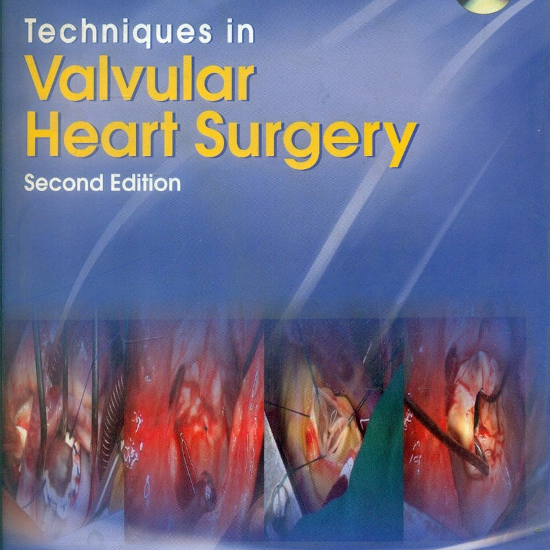 Techniques In Valvular Heart Surgery 2Ed (With Dvd Rom) (Hb 2010), by A Sampath Kumar