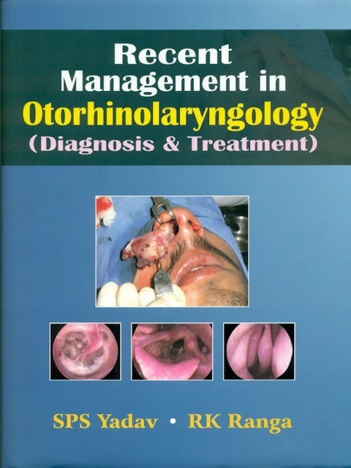 Recent Management In Otorhinolaryngology: Diagnosis & Treatment (Hb) , by S P S Yadav