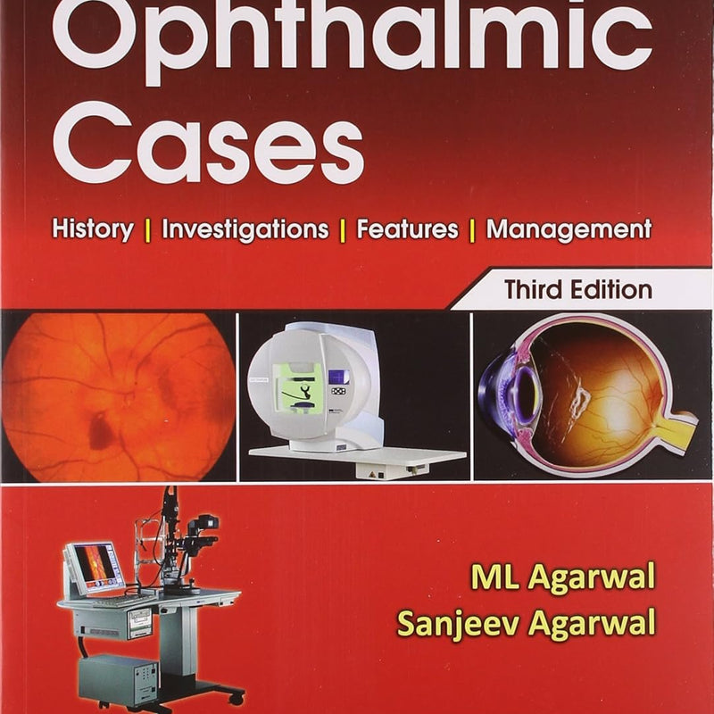 Clinical Examination Of Opthalmic Cases 3E (Pb 2022) , by M L Agarwal