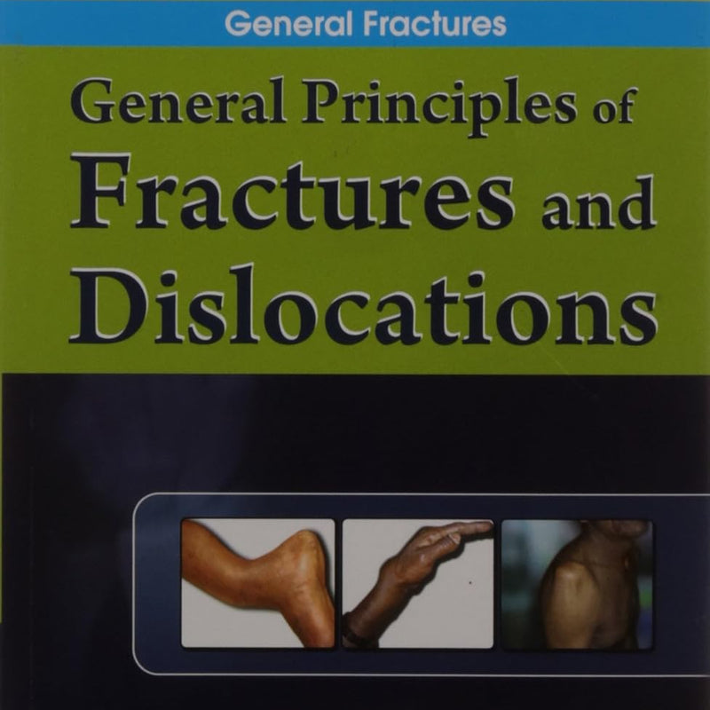 General Principles Of Fractures And Dislocations (Handbook Of Orthopedics And Fractures Series Vol 1 Orthopedic Trauma General Fractures (2012), by John Ebnezar
