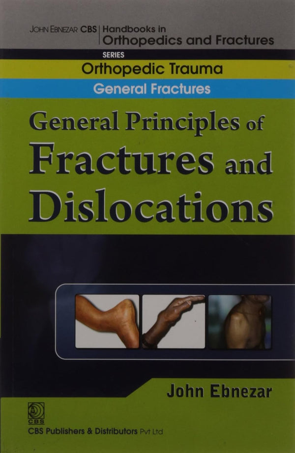General Principles Of Fractures And Dislocations (Handbook Of Orthopedics And Fractures Series Vol 1 Orthopedic Trauma General Fractures (2012), by John Ebnezar