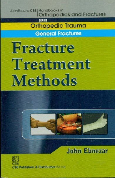 Fracture Treatment Methods (Handbook In Orthopedics And Fractures Vol 02 Orthopedic Trauma General Fractures (2012), by John Ebnezar