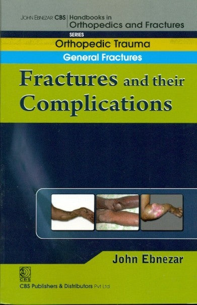 Fractures And Their Complications (Handbook In Orthopedics And Fractures Vol 3 Orthopedic Trauma General Fractures (2012), by John Ebnezar