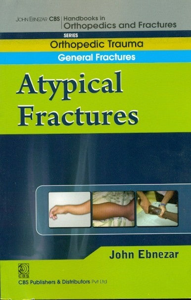 A Typical Fractures (Handbook In Orthopedics And Fractures Vol 4 Orthopedic Trauma General Fractures (2012), by John Ebnezar