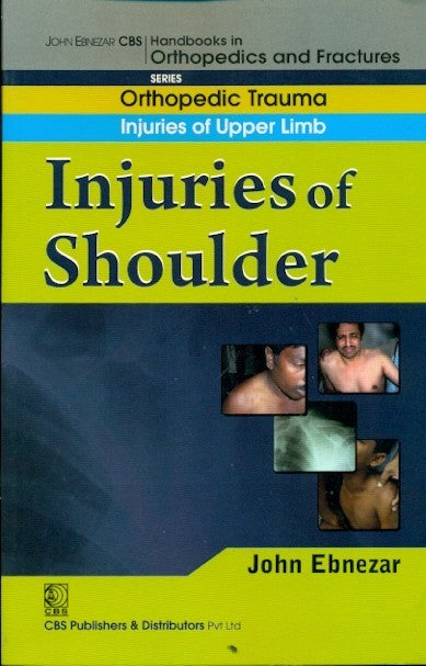Injuries Of Shoulder (Handbook In Orthopedics And Fractures Series Vol 5 Orthopedic Trauma Injuries Of Upper Limb (2012), by John Ebnezar