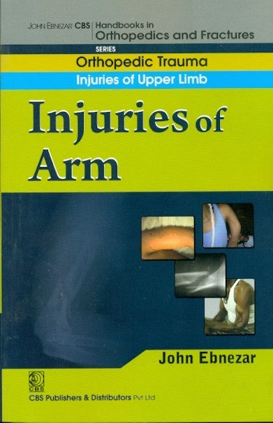 Injuries Of Arm ((Handbook In Orthopedics And Fractures Series Vol 6 Orthopedic Trauma Injuries Of Upper Limb (2012), by John Ebnezar