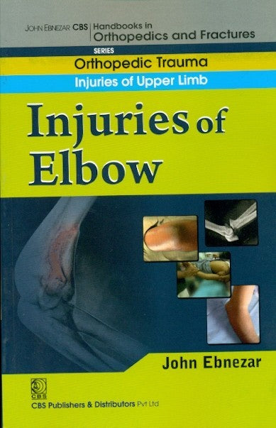 Injuries Of Elbow (Handbook In Orthopedics And Fractures Vol 7 Orthopedic Trauma Injuries Of Upper Limb (2012), by John Ebnezar