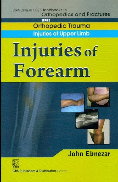 Injuries Of Forearm (Handbook In Orthopedics And Fractures Series Vol 8 Orthopedic Trauma Injuries Of Upper Limb (2012), by John Ebnezar