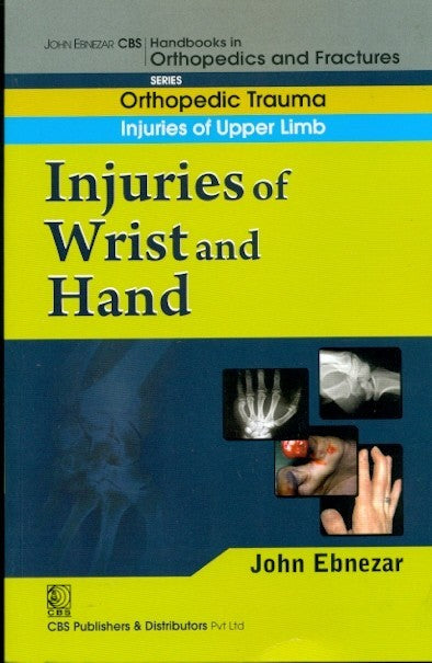 Injuries Of Wrist And Hand (Handbook In Orthopedics And Fractures Vol 9 Orthopedic Trauma Injuries Of Upper Limb (2012), by John Ebnezar