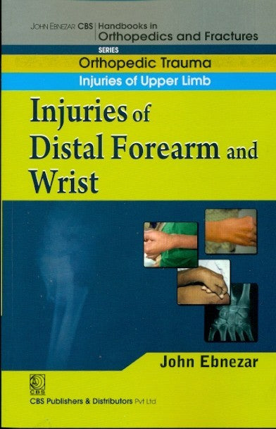 Injuries Of Distal Forearm And Wrist (Handbook In Orthopedics And Fractures Series Vol 10 Orthopedic Trauma Injuries Of Upper Limb (2012), by John Ebnezar