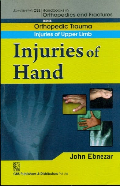 Injuries Of Hand (Handbooks In Orthopedics And Fractures Series Vol 11 Orthopedic Trauma Injuries Of Upper Limb (2012), by John Ebnezar