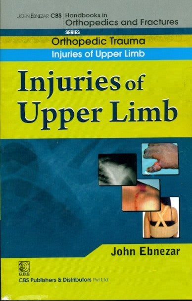 Injuries Of Upper Limb ((Handbook In Orthopedics And Fractures Vol 12 Orthopedic Trauma Injuries Of Upper Limb (2012), by John Ebnezar