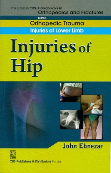 Injuries Of Hip (Handbook Of Orthopedics And Fratures Series Vol 13 Orthopedic Trauma Injuries Of Lower Limb (2012), by John Ebnezar