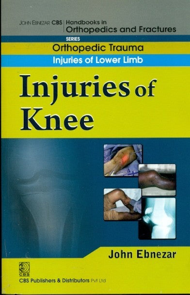 Injuries Of Knee (Handbook Of Orthopedics And Fractures Series Vol 15 Orthopedic Trauma Injuaries Of Lower Limb (2012), by John Ebnezar