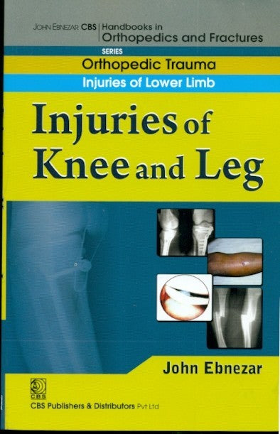 Injuries Of Knee And Leg (Handbook In Orthopedics And Fractures Series Vol 16 Orthopedic Trauma Injuries Of Lower Limb (2012), by John Ebnezar