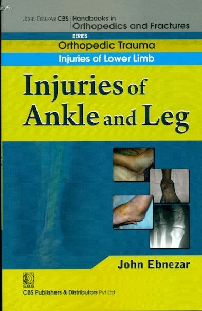 Injuries Of Ankle And Leg (Handbook Of Orthopedics And Fratures Series Vol 17 Orthopedic Trauma Injuries Of Lower Limb (2012), by John Ebnezar